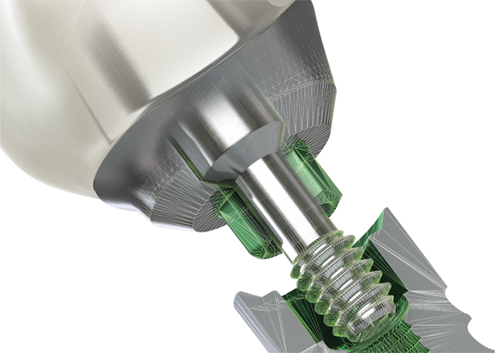 BioHorizons prosthetics abutment BioHorizons prosthetics abutment