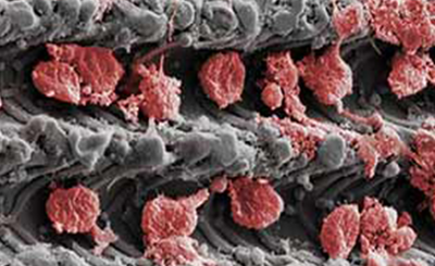 Laser-Lok microchannels